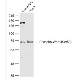 Anti-Phospho-Wee1 (Ser53) antibody-磷酸化WEE1蛋白抗体,Phospho-Wee1 (Ser53)