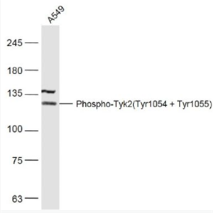 Anti-Phospho-Tyk2 (Tyr1054 + Tyr1055) antibody-磷酸化非受体酪氨酸蛋白激酶2抗体