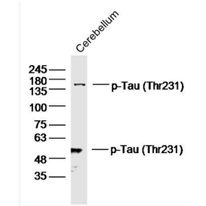 Anti-phospho-Tau (Thr231) antibody-磷酸化微管相关蛋白抗体