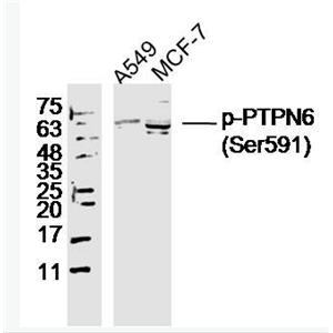 Anti-phospho-PTPN6 (Ser591) antibody-磷酸化蛋白酪氨酸磷酸酶1C抗体