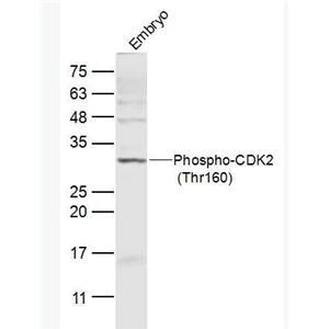 Anti-Phospho-CDK2 (Thr160) antibody-磷酸化周期素依赖性激酶2抗体