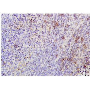 Anti-Phospho-TAK1(Thr184 + Thr187) antibody-磷酸化转化生长因子β活化激酶1抗体