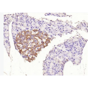 Anti-phospho-IRS1 (Ser312) antibody-磷酸化胰岛素受体底物-1抗体