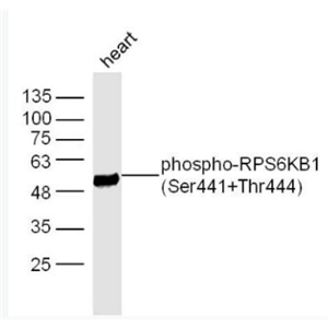 Anti-phospho-RPS6KB1 (Ser441+Thr444) antibody-磷酸化核糖体S6蛋白激酶抗体,phospho-RPS6KB1 (Ser441+Thr444)