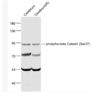 Anti-phospho-beta Catenin (Ser37) antibody-磷酸化β-连环蛋白/β-连环素/β链接素抗体