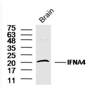 Anti-IFNA4  antibody-干擾素α4抗體,IFNA4