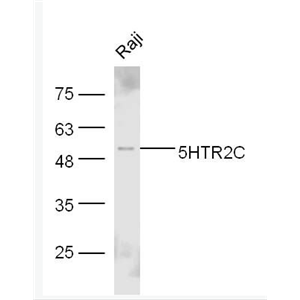 Anti-5HT2C Receptor antibody-5-羟色胺受体2C抗体