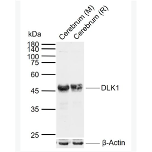 Anti-DLK1 antibody-穿膜蛋白DLK1抗体（C端）