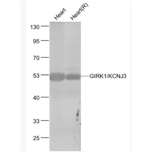 Anti-GIRK1/KCNJ3  antibody-G蛋白激活内向钾通道1抗体