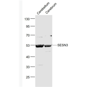 Anti-SESN3 antibody-Sestrin3抗体