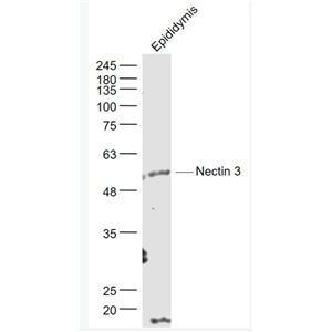 Anti-Nectin 3 antibody-连接蛋白3抗体,Nectin 3