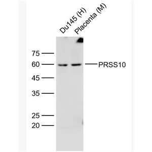 Anti-PRSS10 antibody-丝氨酸蛋白酶10抗体