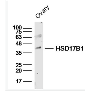 Anti-HSD17B1 antibody-羟类固醇脱氢酶17β抗体