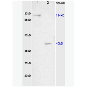 Anti-NALP3/CIAS1  antibody-细胞凋亡诱导蛋白NALP3抗体