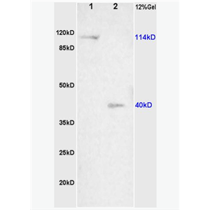 Anti-NALP3/CIAS1  antibody-細(xì)胞凋亡誘導(dǎo)蛋白NALP3抗體,NALP3/CIAS1