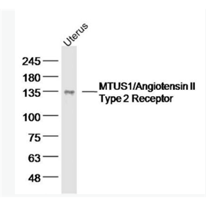 Anti-MTUS1 antibody-微管相关肿瘤抑制因子1 抗体