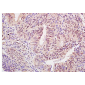 Anti-BARD1 antibody-乳腺癌易感基因环状结构域蛋白抗体