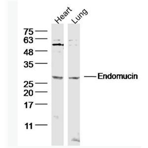 Anti-Endomucin  antibody-内皮粘蛋白EMCN抗体,Endomucin