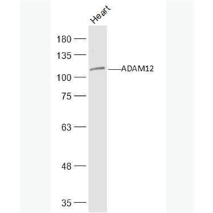 Anti-ADAM12 antibody-去整合素样金属蛋白酶12抗体