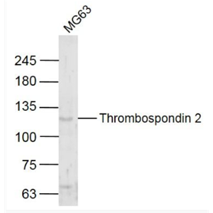 Anti-Thrombospondin 2 antibody-血小板反应蛋白2/凝血酶敏感蛋白2抗体,Thrombospondin 2