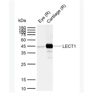 Anti-LECT1 antibody-白细胞衍生化学吸引素抗体