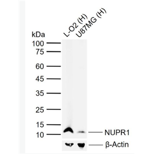 Anti-NUPR1 antibody-核蛋白p8抗体