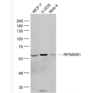 Anti-RPS6KB1 antibody-核糖体p70 S6蛋白激酶抗体