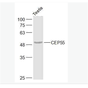 Anti-CEP55 antibody-中心体蛋白55kDa抗体