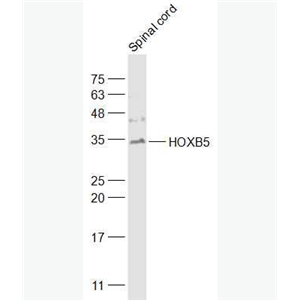 Anti-HOXB5 antibody-同源盒蛋白HOXB5抗体