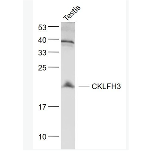 Anti-CKLFH3 antibody-趋化素样因子超家族成员3抗体