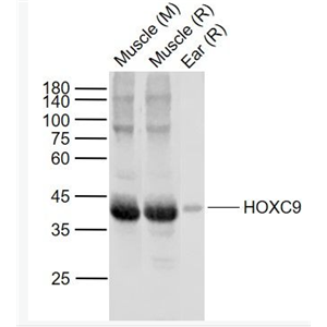 Anti-HOXC9 antibody-同源盒蛋白HOXC9抗体