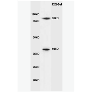 Anti-Cyclin M2 antibody-周期素M2抗体