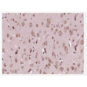 Anti-NEDD4 antibody-神经前体细胞发育下调蛋白4抗体