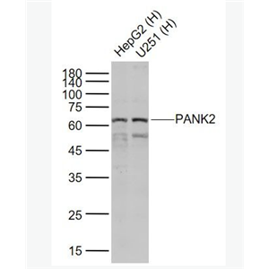 Anti-PANK2 antibody-泛酸激酶2抗体,PANK2