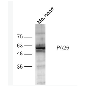 Anti-PA26 antibody-p53调控PA26核蛋白抗体