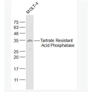 Anti-ACP5 antibody-抗酒石酸酸性磷酸酶5型/5型酸性磷酸酶抗体,ACP5