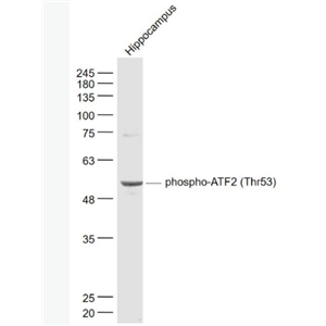 Anti-phospho-ATF2 (Thr53) antibody-磷酸化活化复制因子2抗体