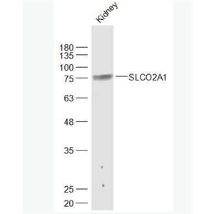 Anti-SLCO2A1 antibody-溶质载体蛋白家族21成员2抗体,SLCO2A1