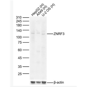 Anti-ZNRF3 antibody-锌指蛋白3/环指蛋白3抗Anti-ZNRF3 antibody-锌指蛋白3/环指蛋白3抗体体