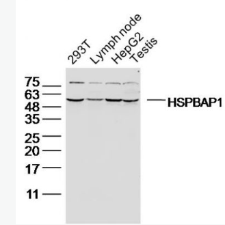 Anti-HSPBAP1 antibody-热休克蛋白27相关蛋白1抗体,HSPBAP1