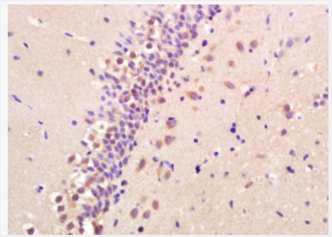 Anti-BNP antibody-腦鈉素/利鈉肽抗體,BNP