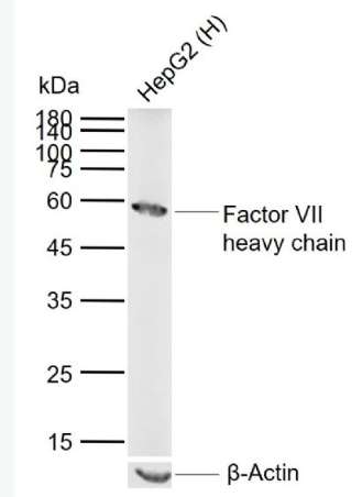 Anti-Factor VII heavy chain antibody-凝血因子7抗体,Factor VII heavy chain