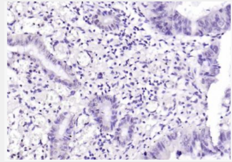 Anti-FIGNL1 antibody-FIGNL1蛋白抗體,FIGNL1