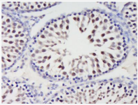 Anti-HSPB7 antibody-熱休克蛋白β7抗體,HSPB7