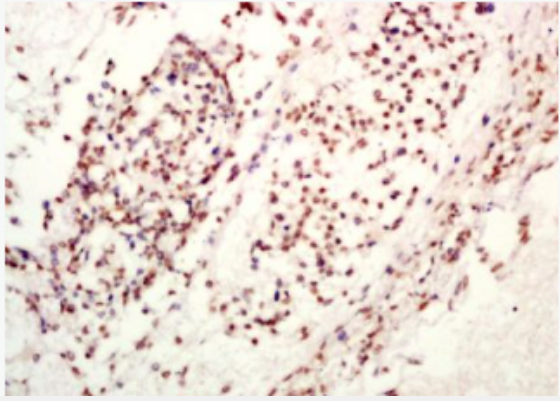 Anti-TET1 antibody-Ten-eleven轉(zhuǎn)運(yùn)基因1蛋白抗體,TET1