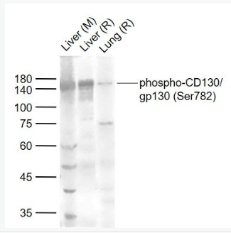 Anti-phospho-CD130/gp130 (Ser782) antibody-磷酸化gp130抗體,phospho-CD130/gp130 (Ser782)