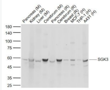 Anti-SGK3 antibody-絲氨酸/蘇氨酸蛋白激酶Sgk3抗體,SGK3