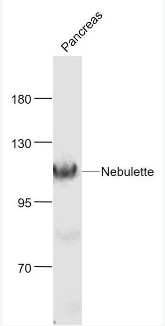 Anti-Nebulette antibody-肌动蛋白结合蛋白Z盘状蛋白抗体,Nebulette