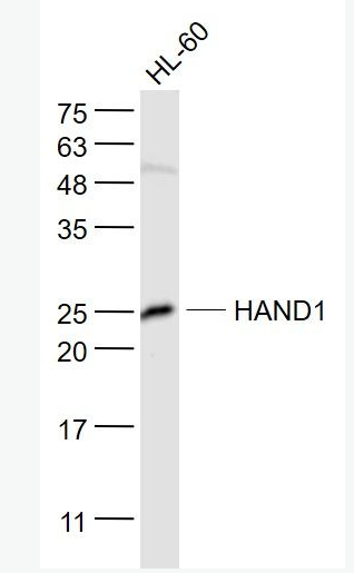 Anti-HAND1  antibody-心脏和神经嵴衍生蛋白1抗体,HAND1