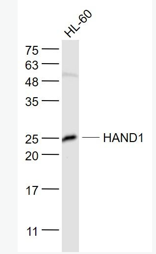 Anti-HAND1  antibody-心臟和神經(jīng)嵴衍生蛋白1抗體,HAND1